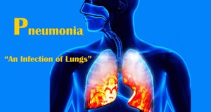 Pneumonia: Causes, Symptoms And Treatment Options!