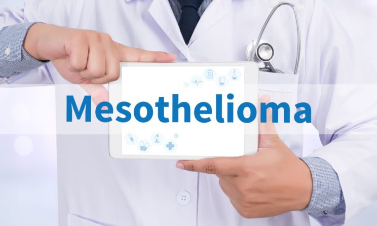 Mesothelioma: Early And Late Stage Symptoms You Need To Know!