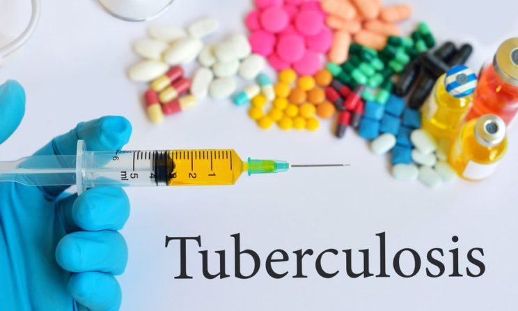 Tuberculosis (TB): Common Symptoms, Treatment And Complications