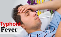 Typhoid Fever: Here Are Causes, Symptoms And Treatment