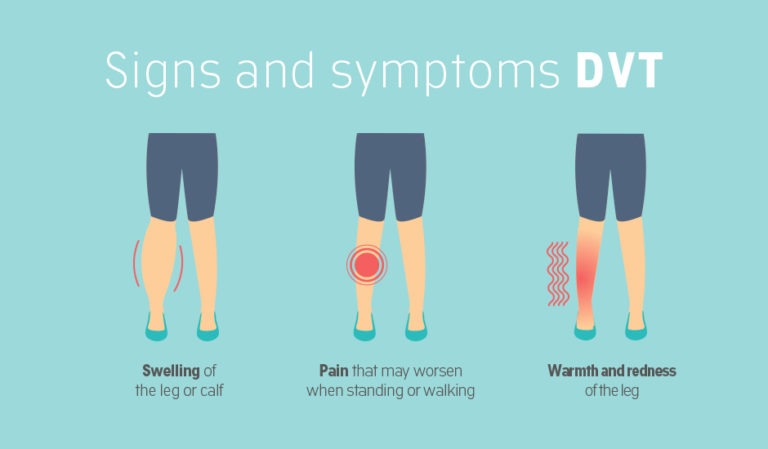 These Are The 5 Natural Ways To Deal With DVT (Deep Vein Thrombosis)